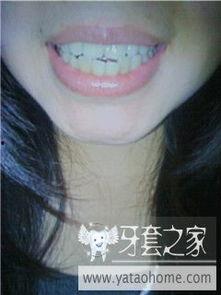 大龅牙搞笑图片,笑出腹肌的搞笑瞬间